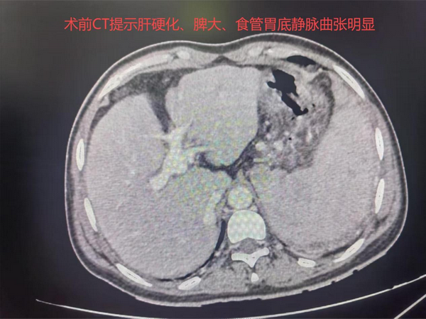 11_调整大小.png