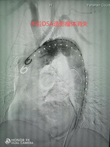 调整大小 44.png